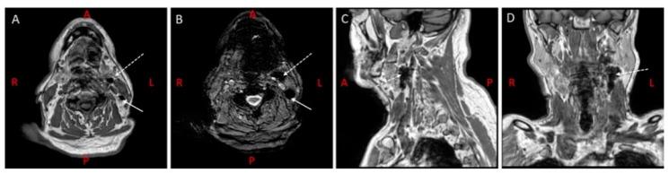 https://cdn.ncbi.nlm.nih.gov/pmc/blobs/081d/7589685/82ec5f6fa9b3/cancers-12-03055-g004.jpg
