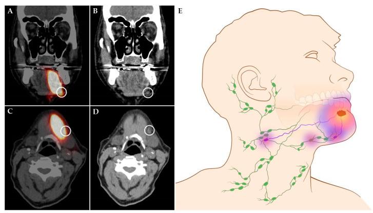 https://cdn.ncbi.nlm.nih.gov/pmc/blobs/081d/7589685/d37a7dddc9f0/cancers-12-03055-g001.jpg