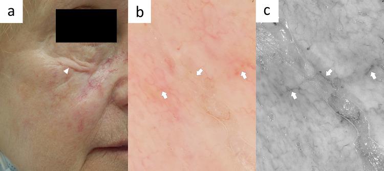 https://cdn.ncbi.nlm.nih.gov/pmc/blobs/0823/10890990/2b1dd5806d85/13555_2024_1104_Fig5_HTML.jpg