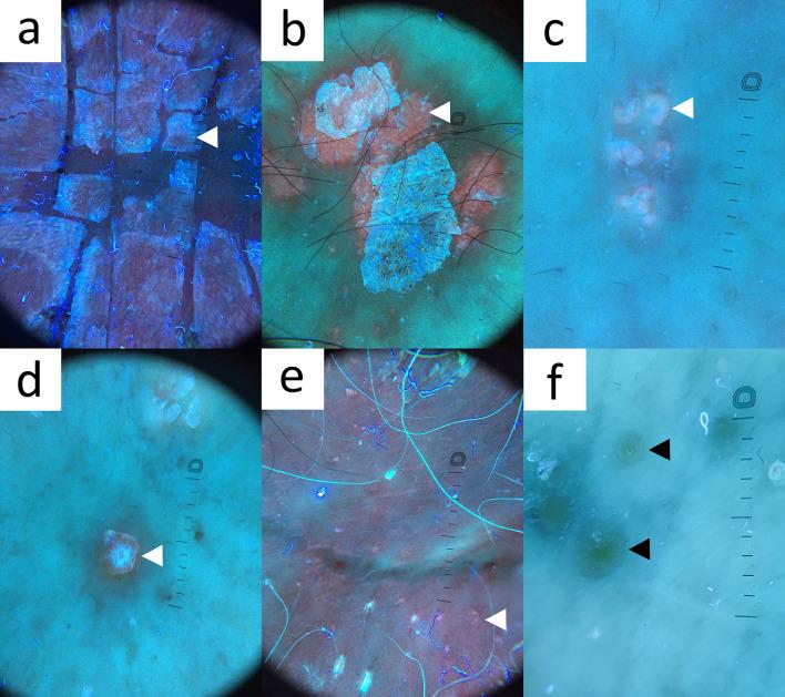 https://cdn.ncbi.nlm.nih.gov/pmc/blobs/0823/10890990/91fc137fe417/13555_2024_1104_Fig12_HTML.jpg
