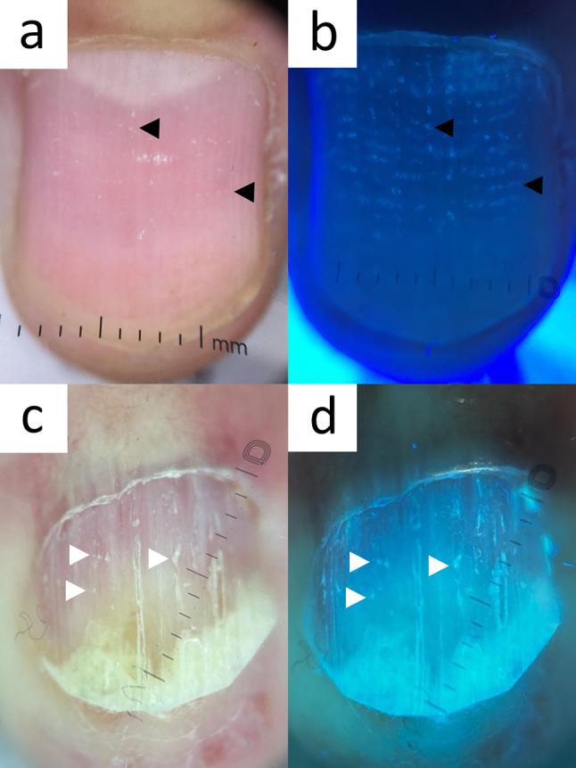 https://cdn.ncbi.nlm.nih.gov/pmc/blobs/0823/10890990/abd20a1fe9ea/13555_2024_1104_Fig13_HTML.jpg