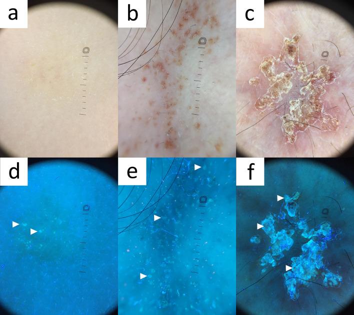 https://cdn.ncbi.nlm.nih.gov/pmc/blobs/0823/10890990/b7d142a8e670/13555_2024_1104_Fig14_HTML.jpg