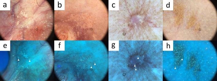 https://cdn.ncbi.nlm.nih.gov/pmc/blobs/0823/10890990/c531f5ed9c8a/13555_2024_1104_Fig18_HTML.jpg
