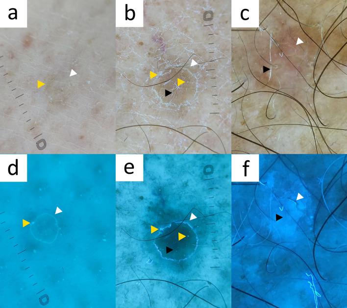 https://cdn.ncbi.nlm.nih.gov/pmc/blobs/0823/10890990/f6b8b0219201/13555_2024_1104_Fig15_HTML.jpg