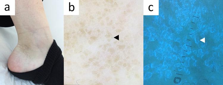 https://cdn.ncbi.nlm.nih.gov/pmc/blobs/0823/10890990/f92fa5891ac7/13555_2024_1104_Fig17_HTML.jpg