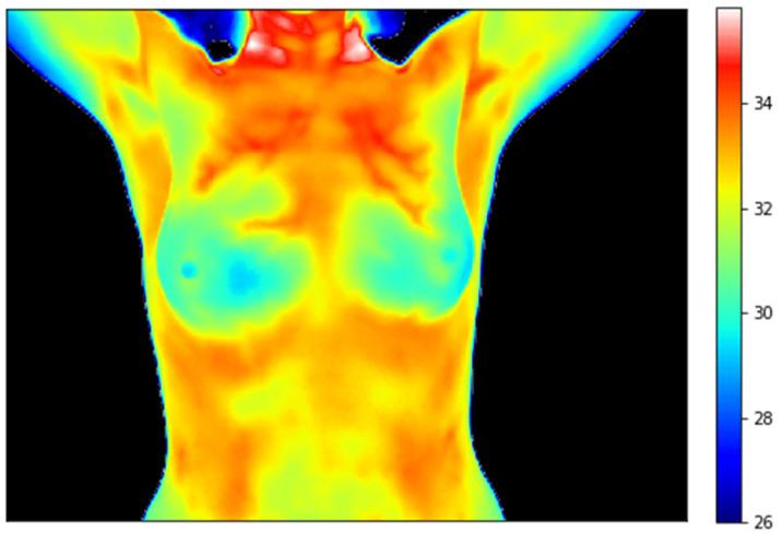 https://cdn.ncbi.nlm.nih.gov/pmc/blobs/082c/12249184/a5f79cfd514b/cancers-17-02195-g001.jpg