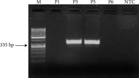 https://cdn.ncbi.nlm.nih.gov/pmc/blobs/082f/8448604/bd9155a7b12d/JRAAS2021-5509280.002.jpg