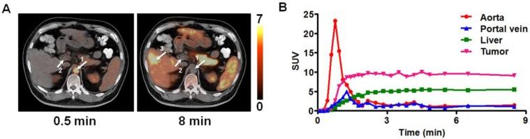 https://cdn.ncbi.nlm.nih.gov/pmc/blobs/0834/4329501/5384b90e24e3/thnov05p0371g001.jpg