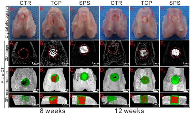 https://cdn.ncbi.nlm.nih.gov/pmc/blobs/0834/5858510/0fcb938c91b9/thnov08p1940g010.jpg
