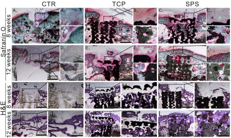 https://cdn.ncbi.nlm.nih.gov/pmc/blobs/0834/5858510/fe1b35c96f2d/thnov08p1940g011.jpg