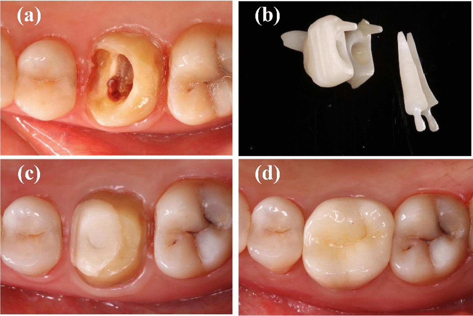 https://cdn.ncbi.nlm.nih.gov/pmc/blobs/0835/9202122/53bd8d8294b1/12903_2022_2273_Fig3_HTML.jpg