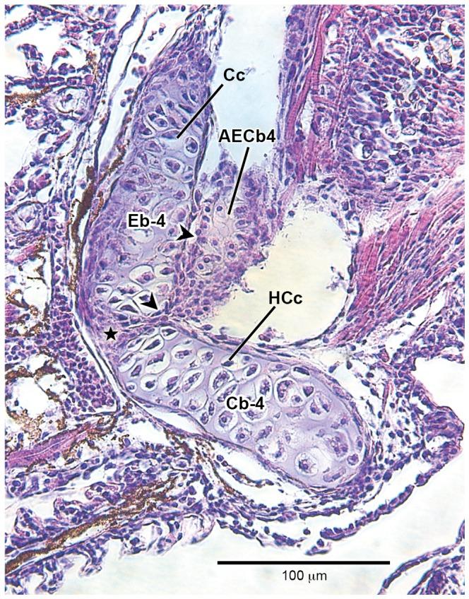 https://cdn.ncbi.nlm.nih.gov/pmc/blobs/083a/3630151/d703923d62b9/pone.0062389.g006.jpg