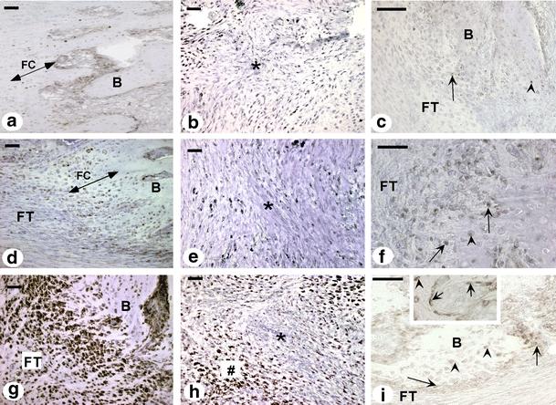 https://cdn.ncbi.nlm.nih.gov/pmc/blobs/083c/2039796/60dfef5defd5/441_2007_448_Fig2_HTML.jpg
