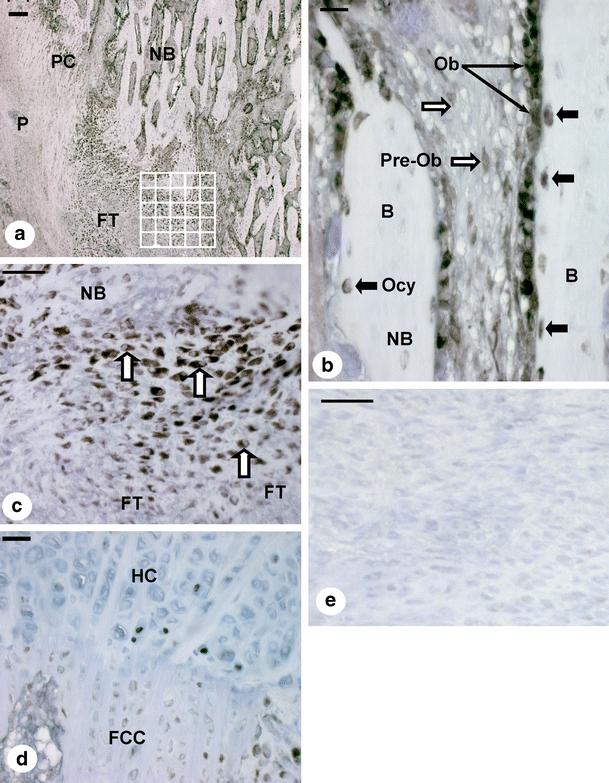https://cdn.ncbi.nlm.nih.gov/pmc/blobs/083c/2039796/6e59fe096f47/441_2007_448_Fig1_HTML.jpg