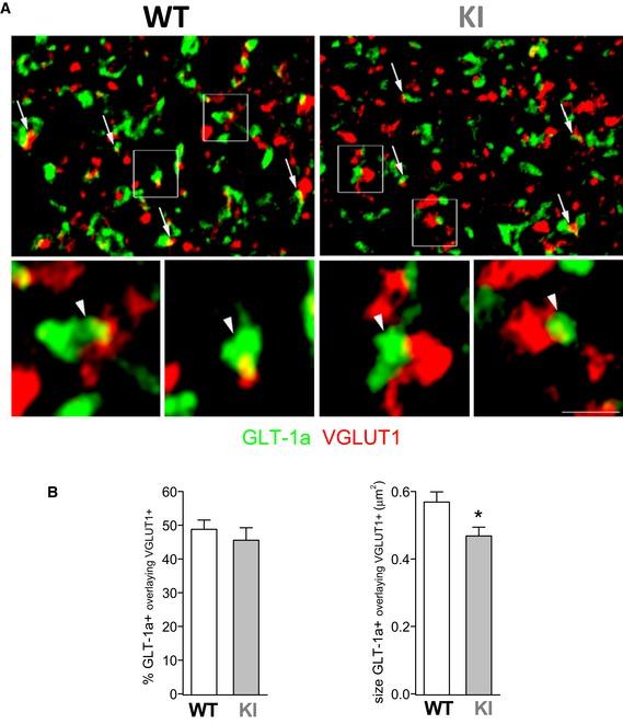 https://cdn.ncbi.nlm.nih.gov/pmc/blobs/083d/4967947/3ac12e3ed72a/EMMM-8-967-g006.jpg