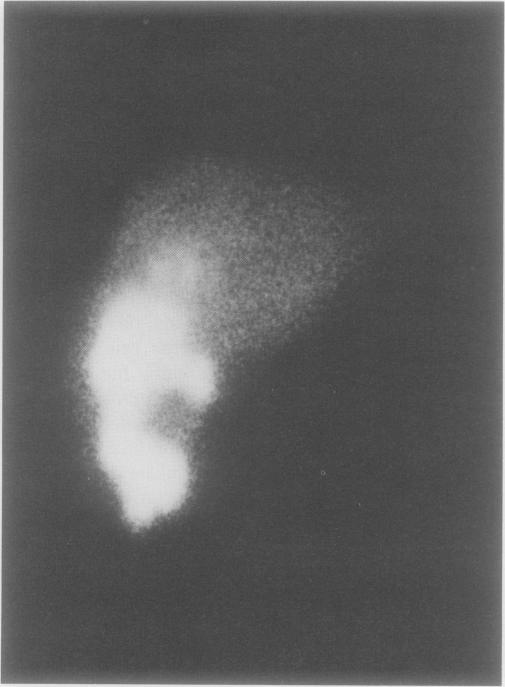 https://cdn.ncbi.nlm.nih.gov/pmc/blobs/083f/1358333/a312a0809aa0/annsurg00157-0074-a.jpg