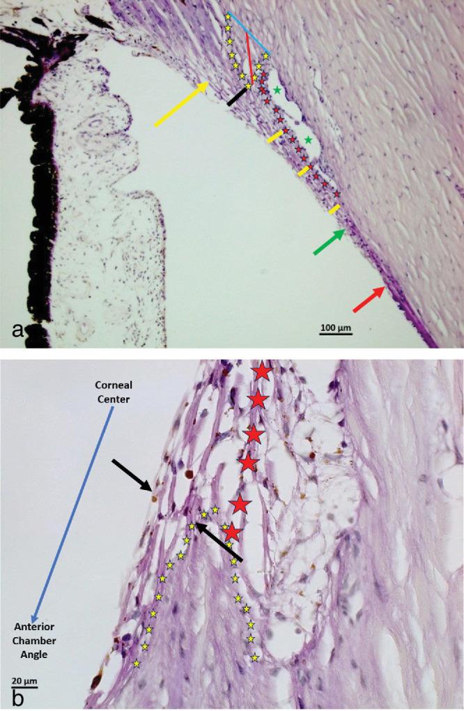 https://cdn.ncbi.nlm.nih.gov/pmc/blobs/0842/11801396/0a26cd7fd012/iovs-66-2-8-f005.jpg