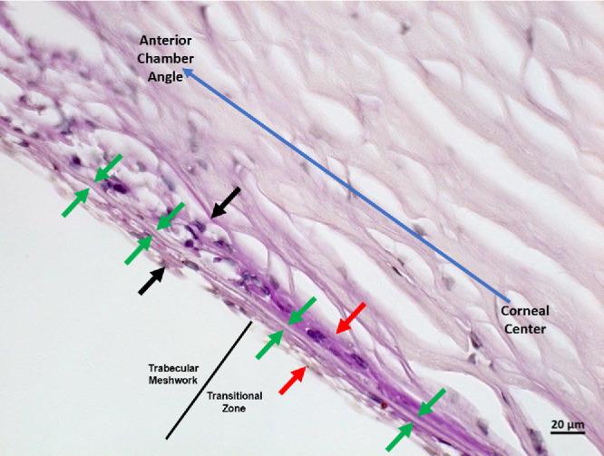 https://cdn.ncbi.nlm.nih.gov/pmc/blobs/0842/11801396/20d55f7e91b8/iovs-66-2-8-f004.jpg