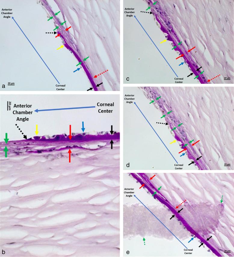 https://cdn.ncbi.nlm.nih.gov/pmc/blobs/0842/11801396/71c4b45b0812/iovs-66-2-8-f002.jpg