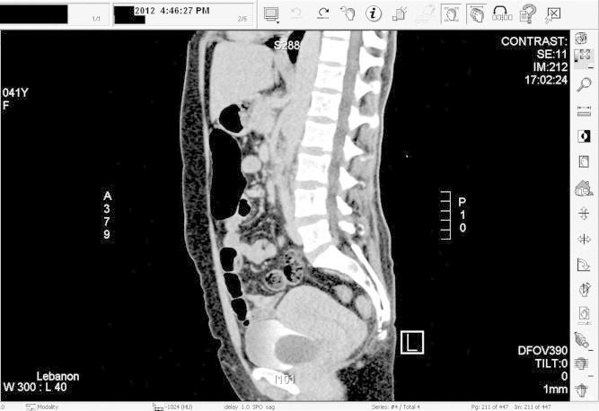 https://cdn.ncbi.nlm.nih.gov/pmc/blobs/0849/4442969/009e175c6c79/gr4.jpg