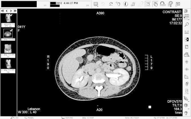 https://cdn.ncbi.nlm.nih.gov/pmc/blobs/0849/4442969/7296847a1eca/gr5.jpg
