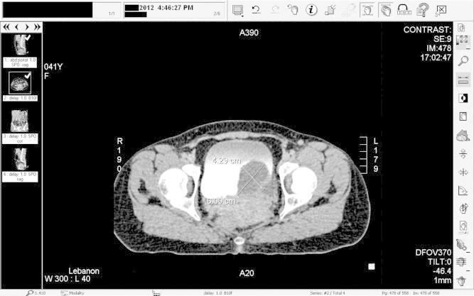 https://cdn.ncbi.nlm.nih.gov/pmc/blobs/0849/4442969/b4a9ced40a2e/gr2.jpg