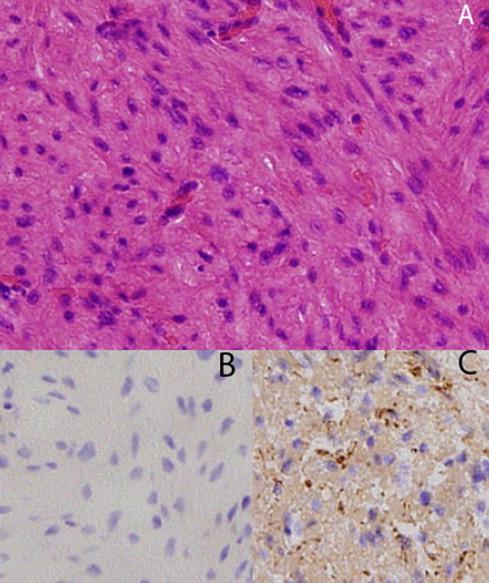 https://cdn.ncbi.nlm.nih.gov/pmc/blobs/0849/4442969/be8c08ca96da/gr6.jpg
