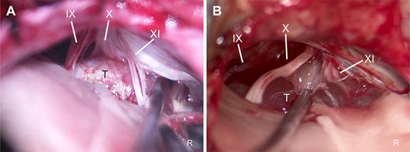 https://cdn.ncbi.nlm.nih.gov/pmc/blobs/0852/11981385/2dc42ca8e26c/ons-28-641-g002.jpg