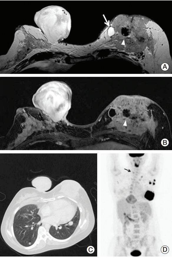 https://cdn.ncbi.nlm.nih.gov/pmc/blobs/0855/6333971/fa195cb4b72e/crt-2017-579f1.jpg