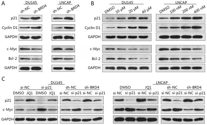 https://cdn.ncbi.nlm.nih.gov/pmc/blobs/0859/6203153/bad7d797f71c/IJO-53-06-2503-g05.jpg