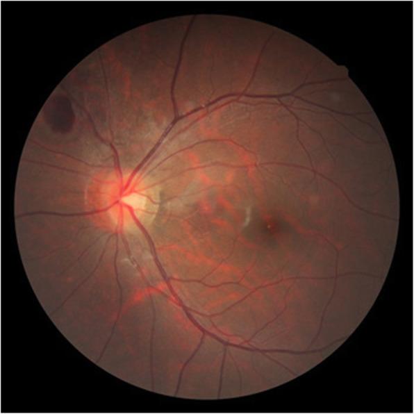 https://cdn.ncbi.nlm.nih.gov/pmc/blobs/085a/7491093/31b77afb2f04/12886_2020_1638_Fig4_HTML.jpg