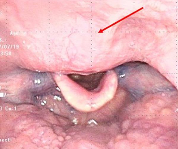 https://cdn.ncbi.nlm.nih.gov/pmc/blobs/085c/6434612/f316dfa0ba18/amjcaserep-20-349-g004.jpg