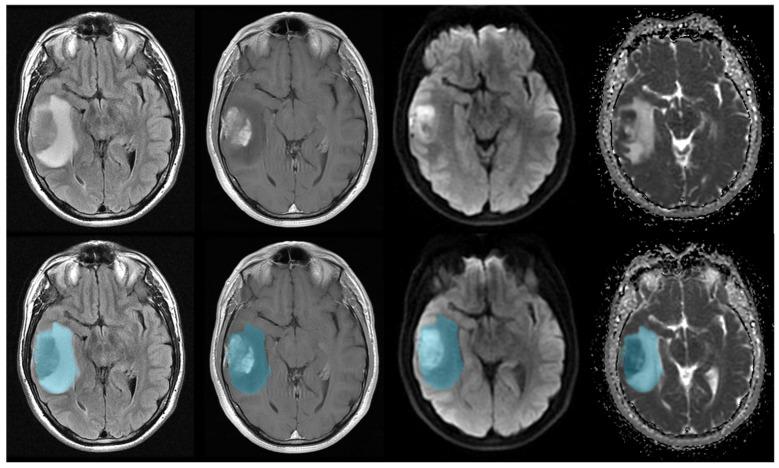 https://cdn.ncbi.nlm.nih.gov/pmc/blobs/0865/10854536/3a85ba0abf56/cancers-16-00589-g001.jpg
