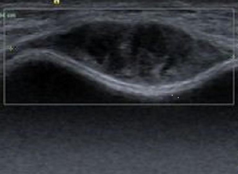 https://cdn.ncbi.nlm.nih.gov/pmc/blobs/0865/9256978/0dbac5045a20/fonc-12-878635-g001.jpg