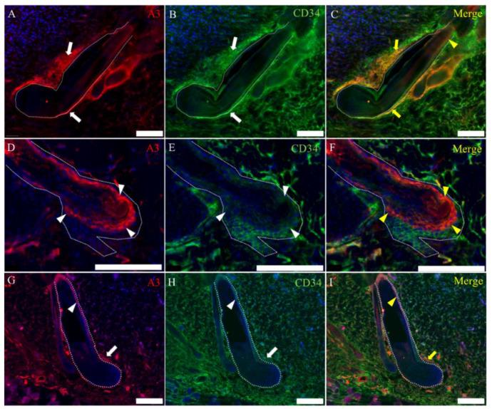 https://cdn.ncbi.nlm.nih.gov/pmc/blobs/086b/7312608/0e4d34481a08/ijms-21-03806-g009.jpg