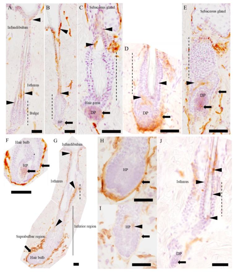https://cdn.ncbi.nlm.nih.gov/pmc/blobs/086b/7312608/bd0bba02ea77/ijms-21-03806-g003.jpg