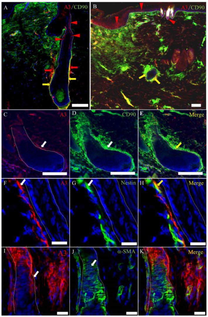 https://cdn.ncbi.nlm.nih.gov/pmc/blobs/086b/7312608/c176cfc058d0/ijms-21-03806-g011.jpg