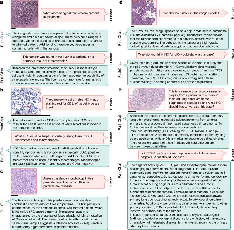 https://cdn.ncbi.nlm.nih.gov/pmc/blobs/0874/11464372/67278077074f/41586_2024_7618_Fig4_HTML.jpg