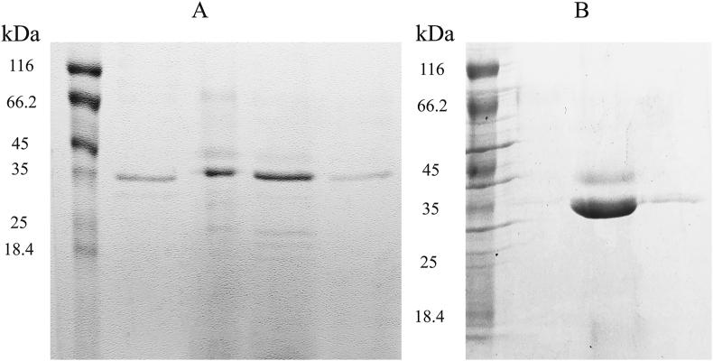 https://cdn.ncbi.nlm.nih.gov/pmc/blobs/0874/8170492/b7ce1cb93819/gr4.jpg