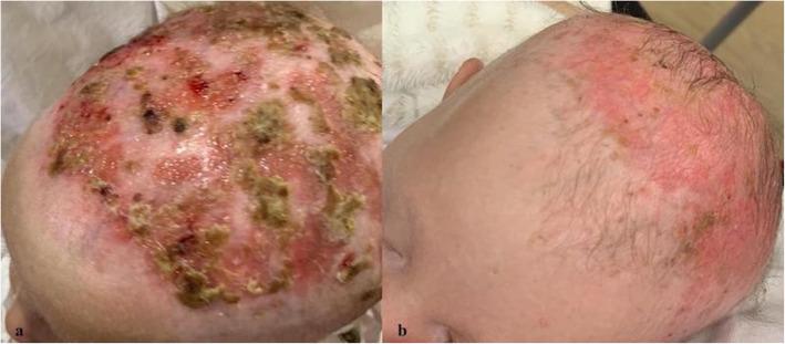 https://cdn.ncbi.nlm.nih.gov/pmc/blobs/0876/8479907/8ae3d43b5817/13052_2021_1152_Fig2_HTML.jpg