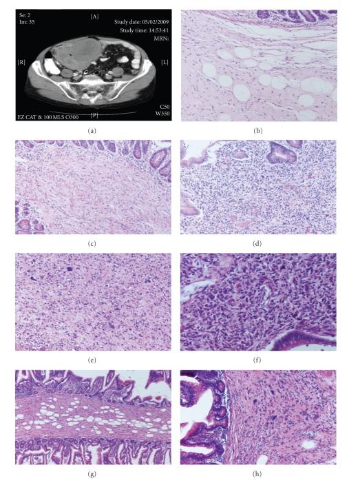 https://cdn.ncbi.nlm.nih.gov/pmc/blobs/0878/2913843/afdb9074c32d/SRCM2010-807981.001.jpg