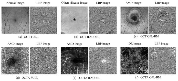 https://cdn.ncbi.nlm.nih.gov/pmc/blobs/087b/11359948/1f662e900381/sensors-24-05227-g003.jpg