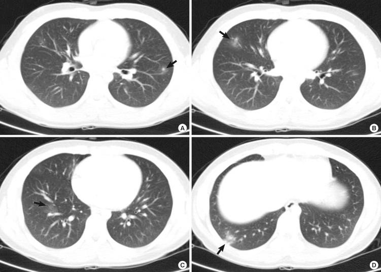 https://cdn.ncbi.nlm.nih.gov/pmc/blobs/0886/3429831/c689ead8fc40/jkms-27-1105-g001.jpg