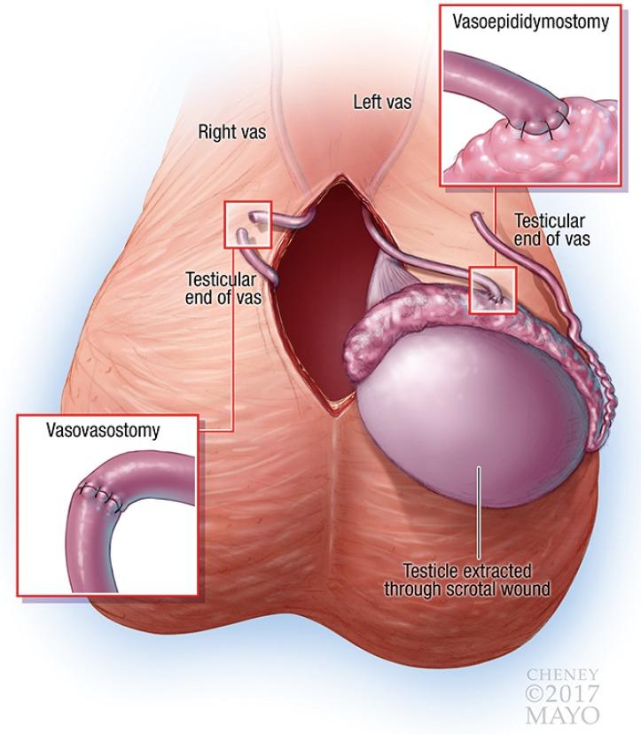 https://cdn.ncbi.nlm.nih.gov/pmc/blobs/0888/5583048/0e4e56f13ded/tau-06-04-761-f3.jpg