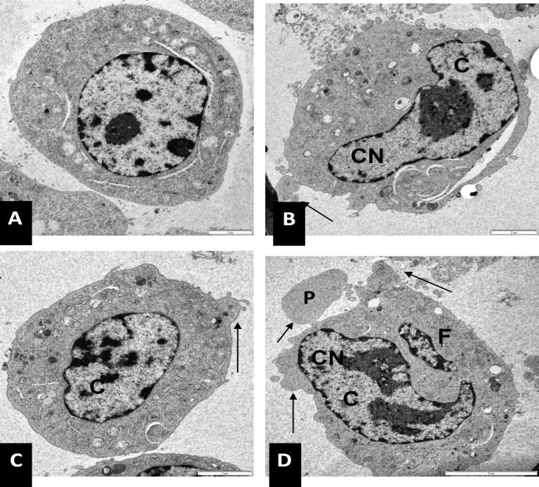https://cdn.ncbi.nlm.nih.gov/pmc/blobs/0892/11700348/260b6cbc85c0/APJCP-25-2991-g003.jpg