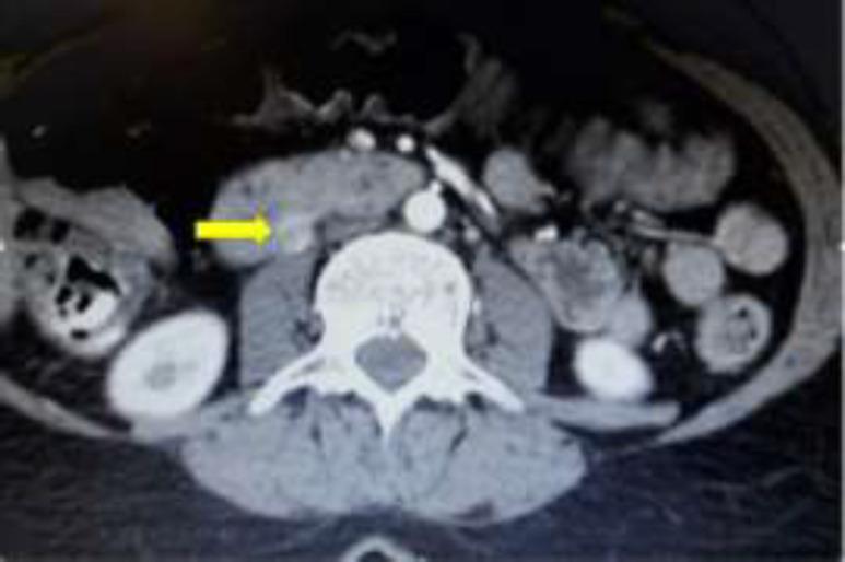 https://cdn.ncbi.nlm.nih.gov/pmc/blobs/0896/8559628/78c90eaa5458/cjim-12-447-g001.jpg
