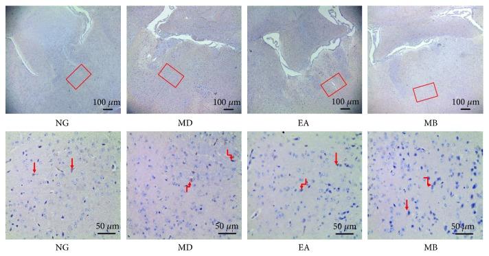 https://cdn.ncbi.nlm.nih.gov/pmc/blobs/089d/6383400/b211162734bc/GRP2019-2345890.007.jpg
