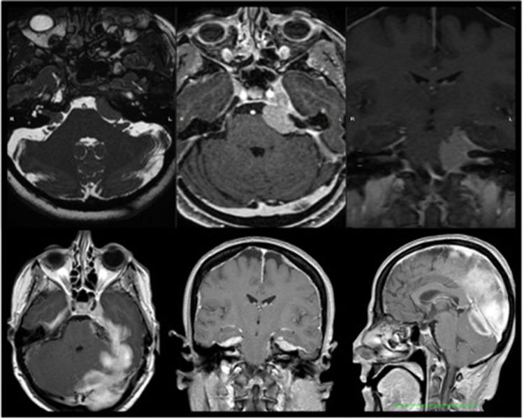 https://cdn.ncbi.nlm.nih.gov/pmc/blobs/089e/9800793/5058c971823a/fsurg-09-1021019-g002.jpg