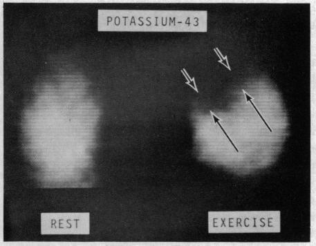 https://cdn.ncbi.nlm.nih.gov/pmc/blobs/08a0/1455243/750906e63f77/califmed00003-0079-b.jpg