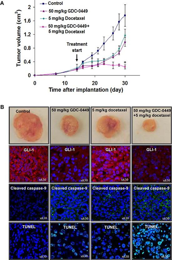 https://cdn.ncbi.nlm.nih.gov/pmc/blobs/08a0/4414161/cef2848526b2/oncotarget-06-3887-g006.jpg